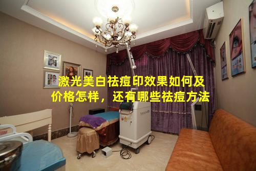 激光美白祛痘印效果如何及价格怎样，还有哪些祛痘方法